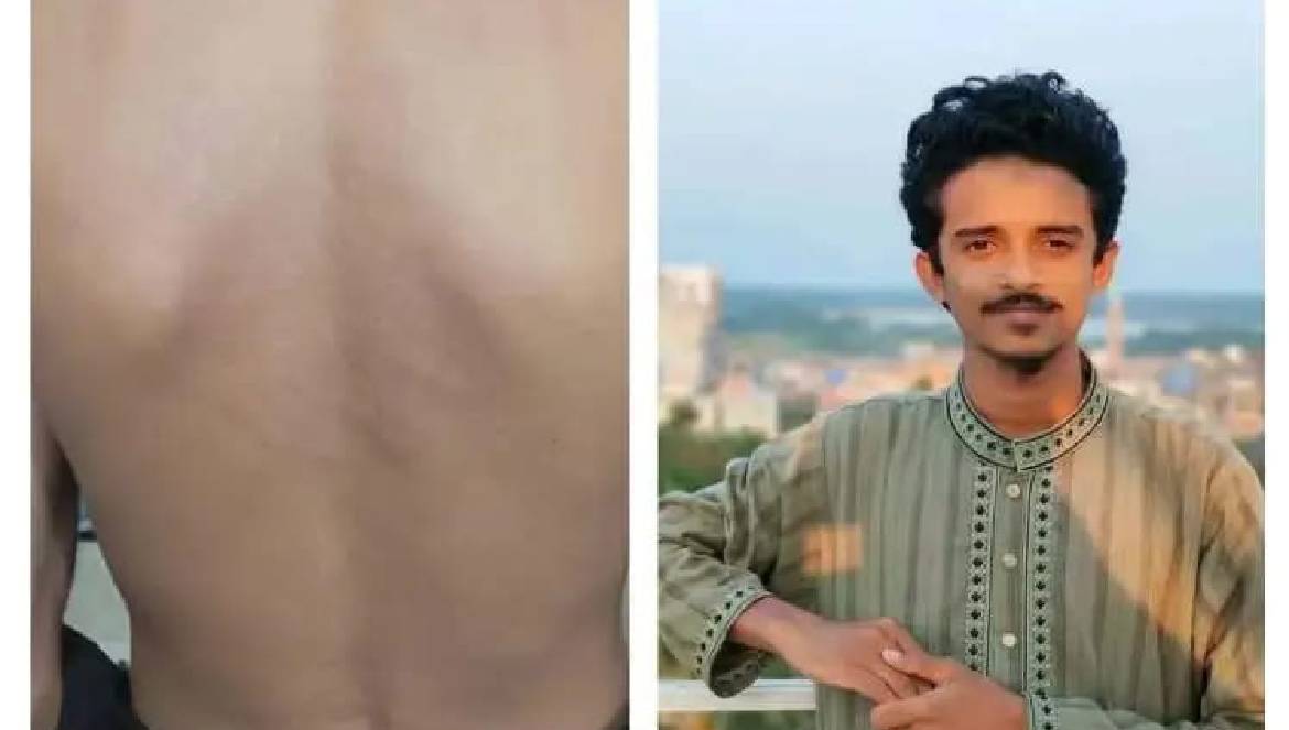 শিবির করায় ববির এক কর্মচারীকে ছাত্রদলের মারধর, অতঃপর চাকরিচ্যুত