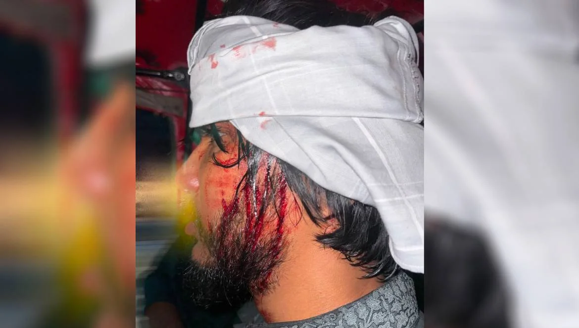 নোয়াখালীতে আওয়ামী লীগ-বিএনপি সংঘর্ষ, পাল্টাপাল্টি অগ্নিসংযোগ